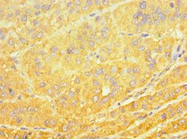 CYP4A11 Antibody