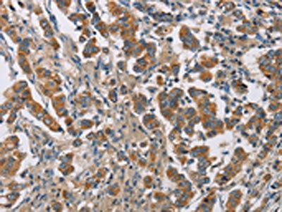 CYP4A11 antibody