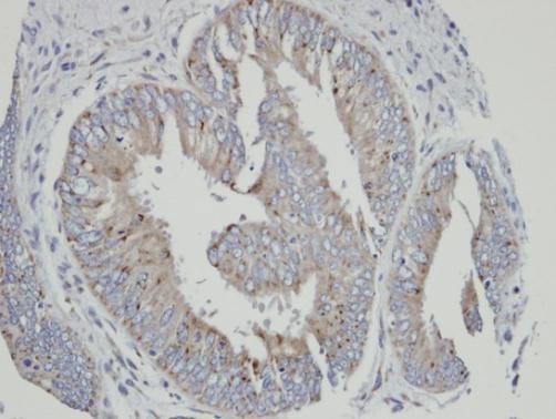 CYP4A11 antibody [N1C1]