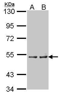 CYP4A11 antibody [N1C1]