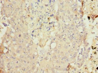 CYP4B1 antibody