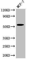 CYP51A1 antibody