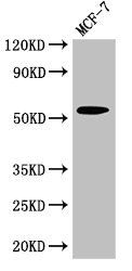 CYP51A1 Antibody