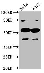 CYP7A1 Antibody