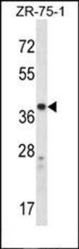 CYSLTR1 antibody