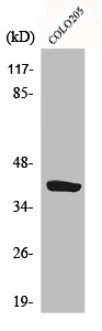 CYSLTR1 antibody