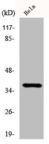 CYSLTR2 antibody