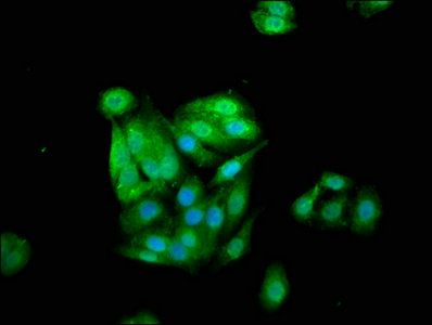 CSTB Antibody