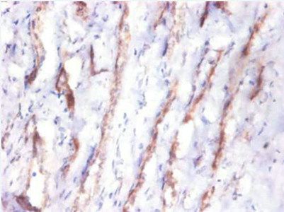 Cystatin C antibody