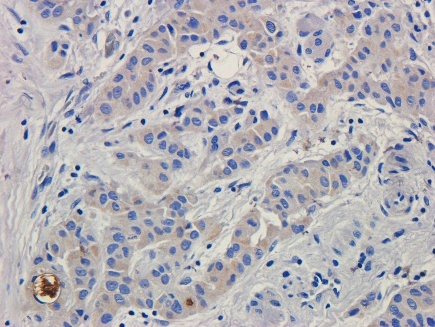 Cystatin C antibody