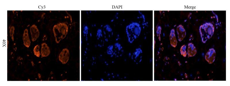 Cystatin C antibody