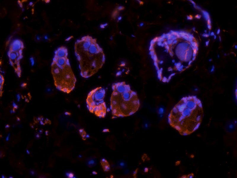 Cystatin C antibody