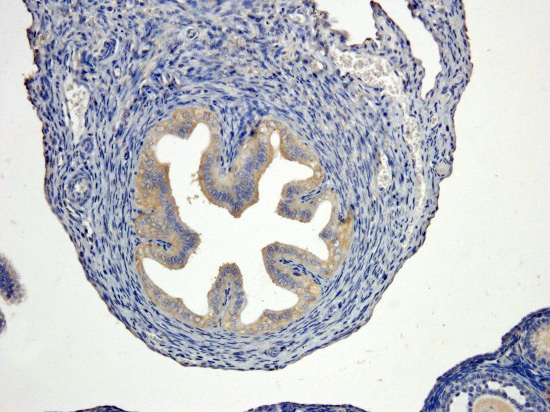 Cystatin C antibody