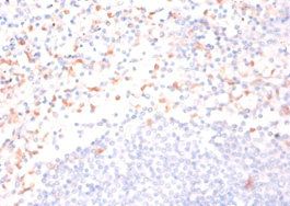 CDA Antibody