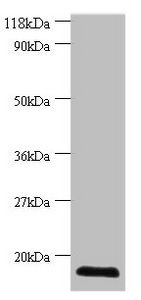 Cytidine deaminase antibody