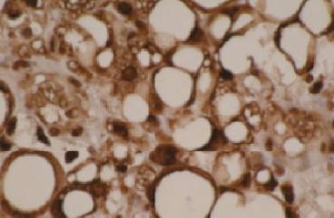 Mouse anti Human Cytochrome P450 4F11 Antibody