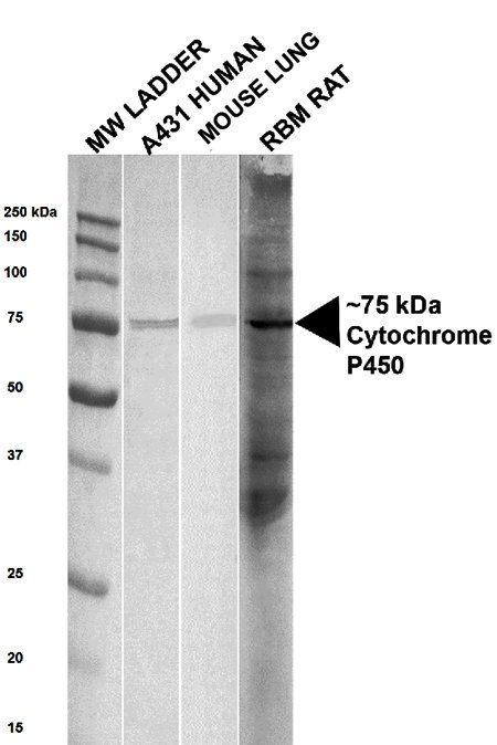 Cytochrome P450 Reductase Antibody [Out of stock]