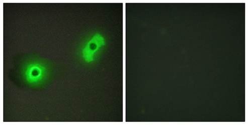 Cytochrome P450 27A1 antibody