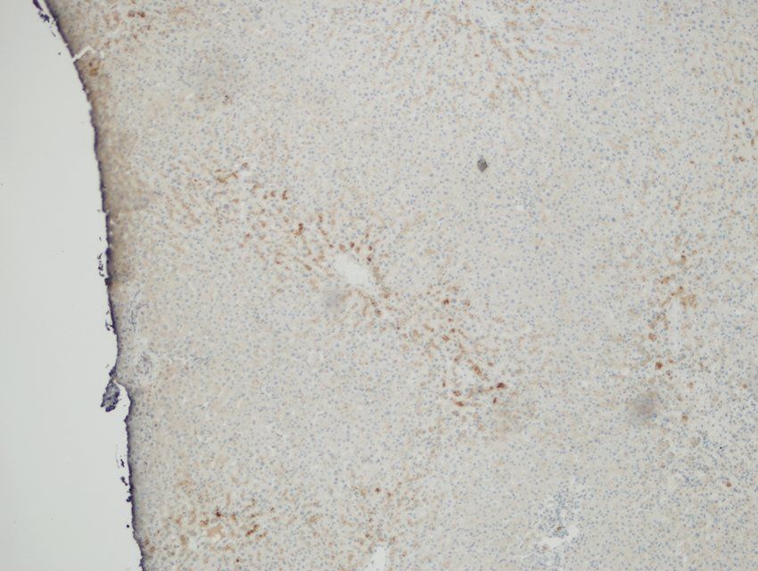 Cytochrome P450 2B1 Rabbit Polyclonal Antibody