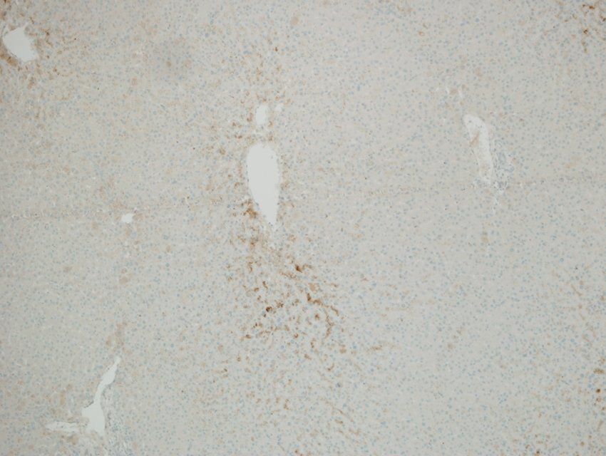 Cytochrome P450 2B1 Rabbit Polyclonal Antibody