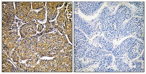 Cytochrome P450 8B1 Antibody
