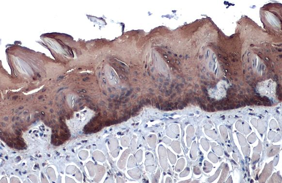 Cytokeratin 13 antibody