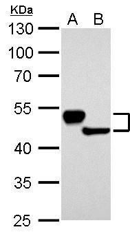 keratin 13 Antibody