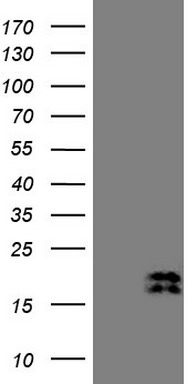 Cytokeratin 16 Antibody