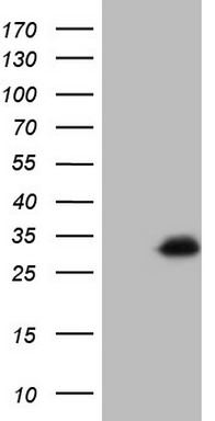 Cytokeratin 16 Antibody