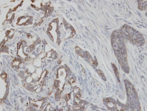Cytokeratin 2 antibody [N2C2], Internal