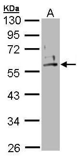 Cytokeratin 2 antibody