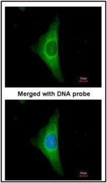 keratin 20 Antibody