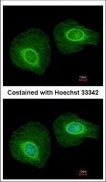 Cytokeratin 34 Rabbit Polyclonal Antibody