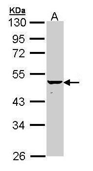 Cytokeratin 34 antibody