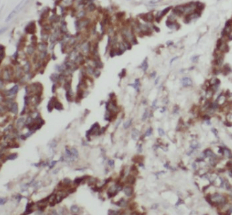 Cytokeratin 6A antibody