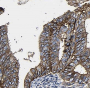 Cytokeratin 7-specific antibody