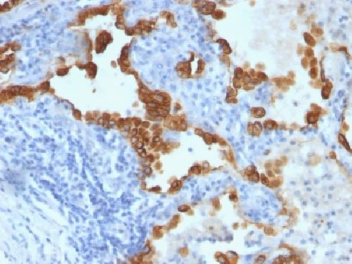 KRT8 Antibody