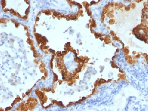 KRT8 Antibody