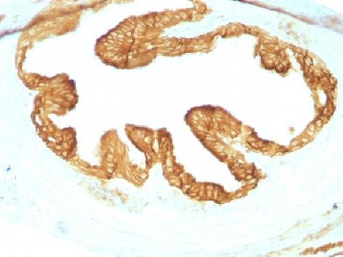 Cytokeratin antibody