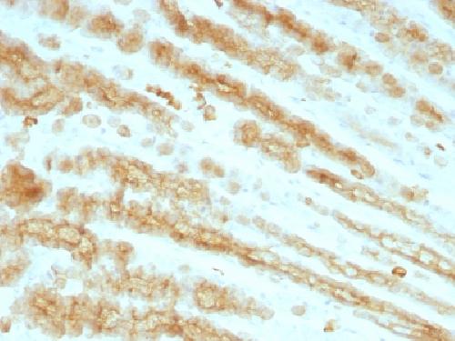 Cytokeratin, pan (Epithelial Marker) Antibody