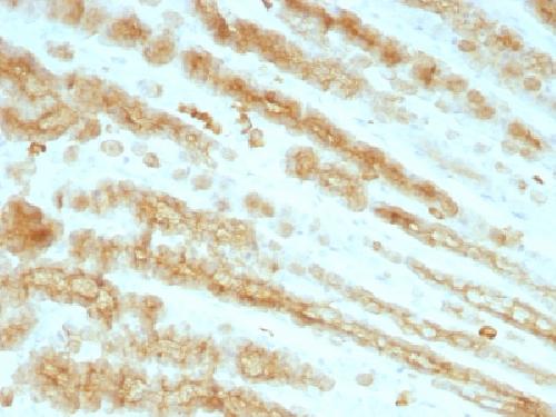 Cytokeratin antibody