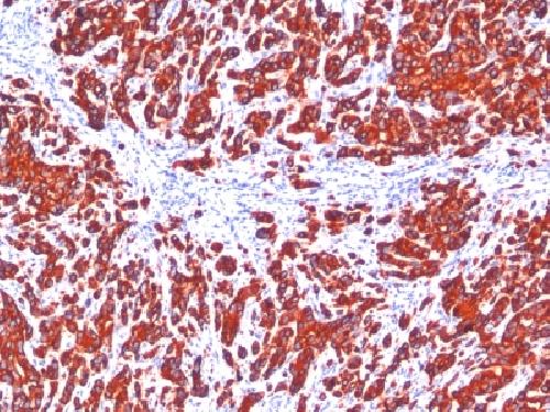 Cytokeratin, pan (Epithelial Marker) Antibody