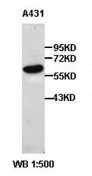Cytokeratin 5 Rabbit Polyclonal Antibody