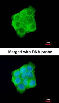 Cytokeratin 13 antibody