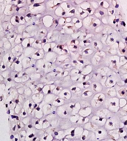 CK14+17+42+10 Rabbit Polyclonal Antibody