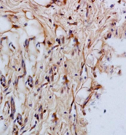 CK14+17+42+10 Rabbit Polyclonal Antibody