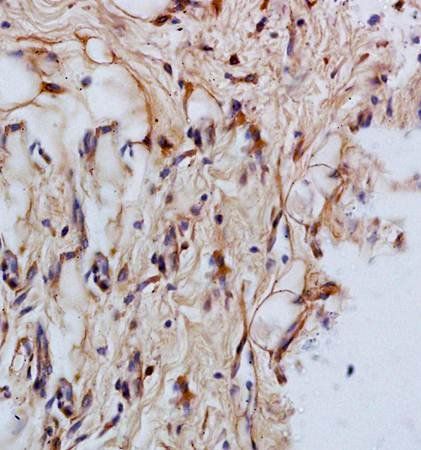 Cytokeratin 14 antibody