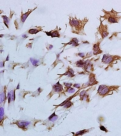 CK14+17+42+10 Rabbit Polyclonal Antibody