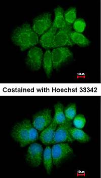 Cytokeratin 2e antibody