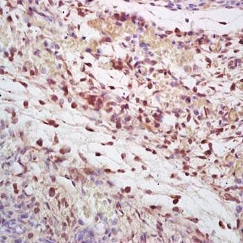 Cytokeratin 3+12 Rabbit Polyclonal Antibody